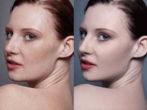 人像拍摄后期-美白对比